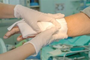 Nurse treating a patient with a burn injury