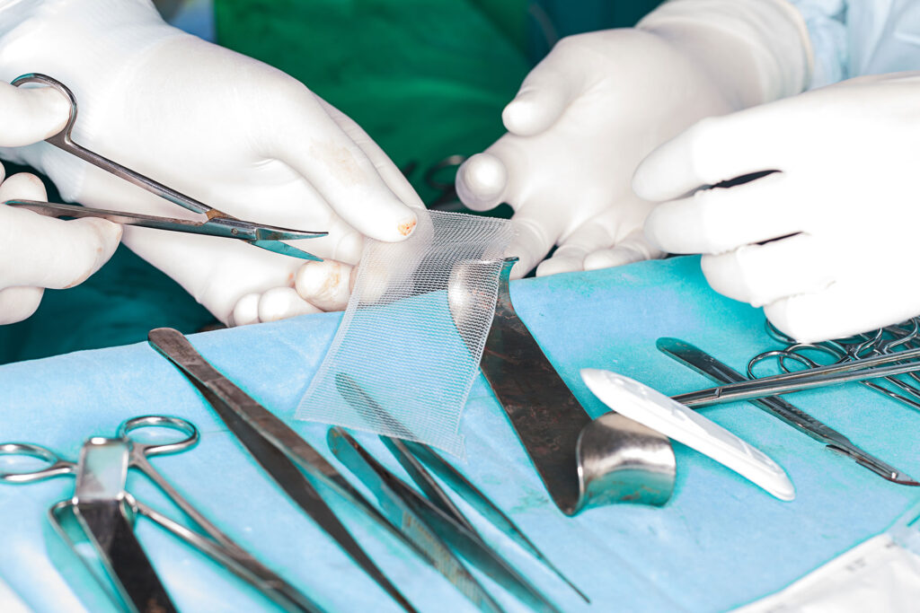 Hernia-Mesh